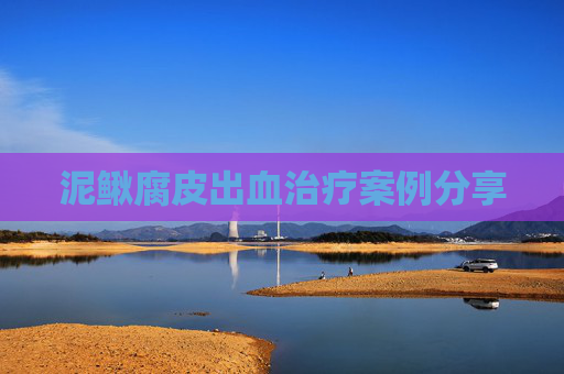 泥鳅腐皮出血治疗案例分享